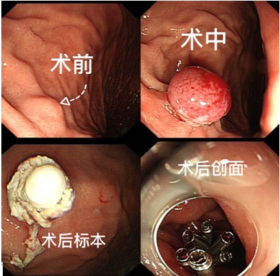 Snipaste_2023-06-19_08-22-53.jpg Snipaste_2023-06-19_08-22-53.jpg