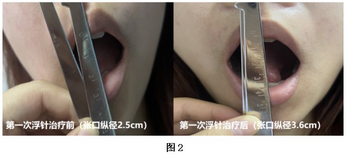 Snipaste_2024-06-21_08-33-13.jpg Snipaste_2024-06-21_08-33-13.jpg