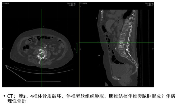 Snipaste_2024-11-07_11-45-53.jpg Snipaste_2024-11-07_11-45-53.jpg