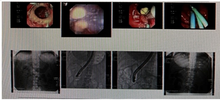 Snipaste_2025-05-16_15-51-17.jpg Snipaste_2025-05-16_15-51-17.jpg