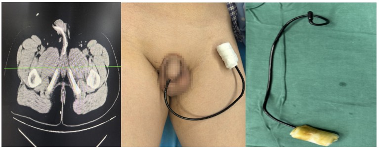 Snipaste_2025-05-30_15-54-17.jpg Snipaste_2025-05-30_15-54-17.jpg